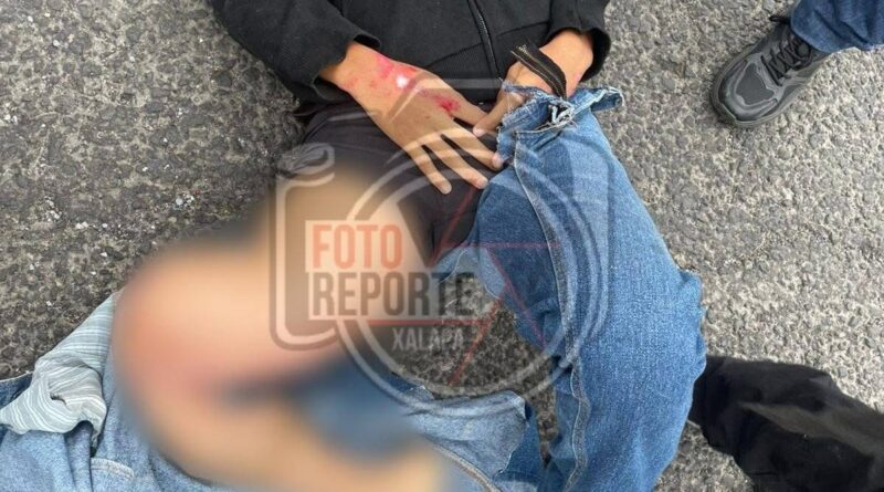 Menor de edad resulta lesionado tras ser atropellado por motocicleta